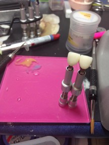 ZIRCONIO SOPER TRASLUCIDO